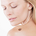 Eliminar Tatuajes
